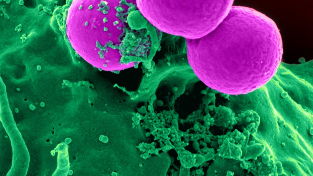 harnwegsinfekt geht nicht weg trotz antibiotika forum